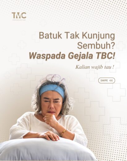 tbc_1